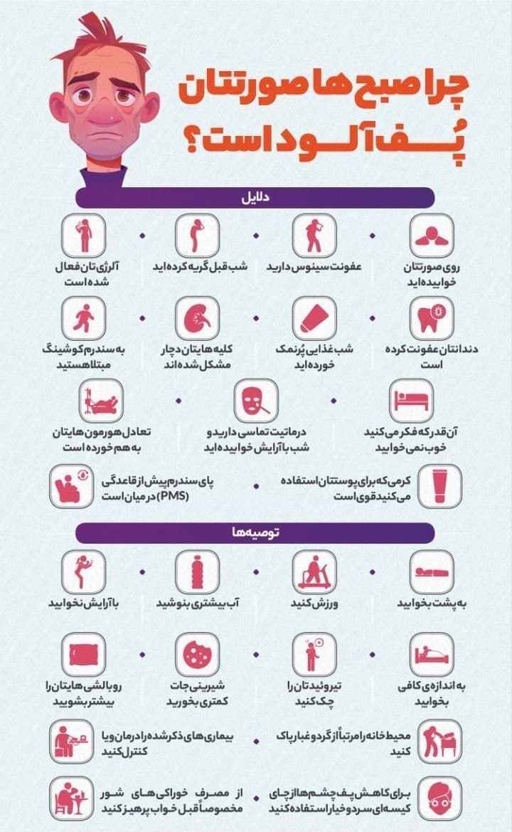 چرا صبحها صورتمون پُف داره؟ این 10 بیماری علت پُف صبحگاهی صورت است ...